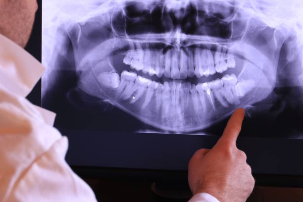 Best Emergency Tooth Extraction in Henryetta, OK