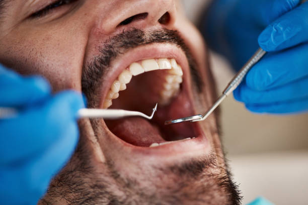 Best Emergency Dental Care for Broken or Chipped Teeth in Henryetta, OK